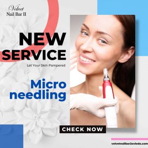 velvet-nail-bar-2-nail-salon-oviedo-nail-salon-fl-32765-microneedling